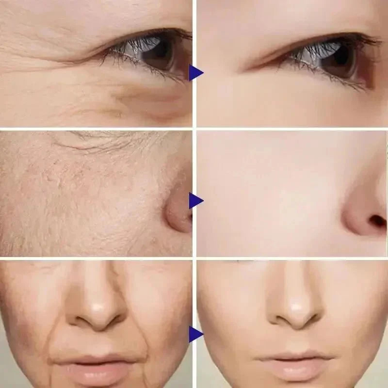 RevitLift™ Retinol Pro - Enrichment Kit | Advanced Firming & Fine Line Recovery - GiftWave.co