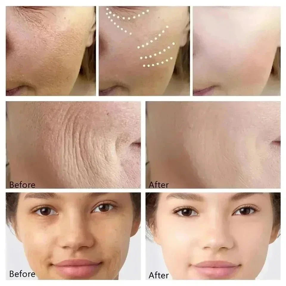 RevitLift™ Retinol Pro - Enrichment Kit | Advanced Firming & Fine Line Recovery - GiftWave.co