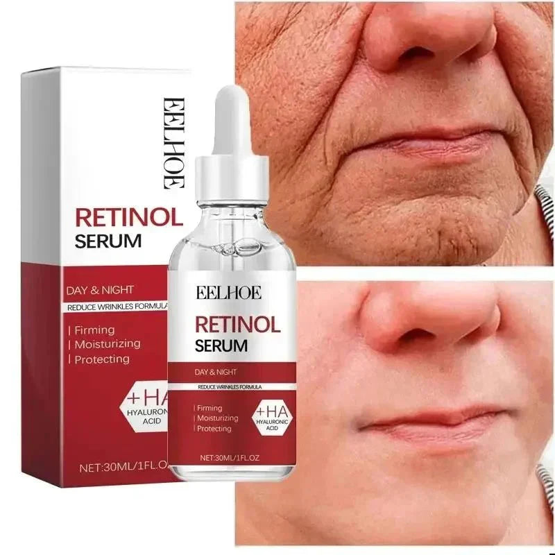 RevitLift™ Retinol Pro - Enrichment Kit | Advanced Firming & Fine Line Recovery - GiftWave.co