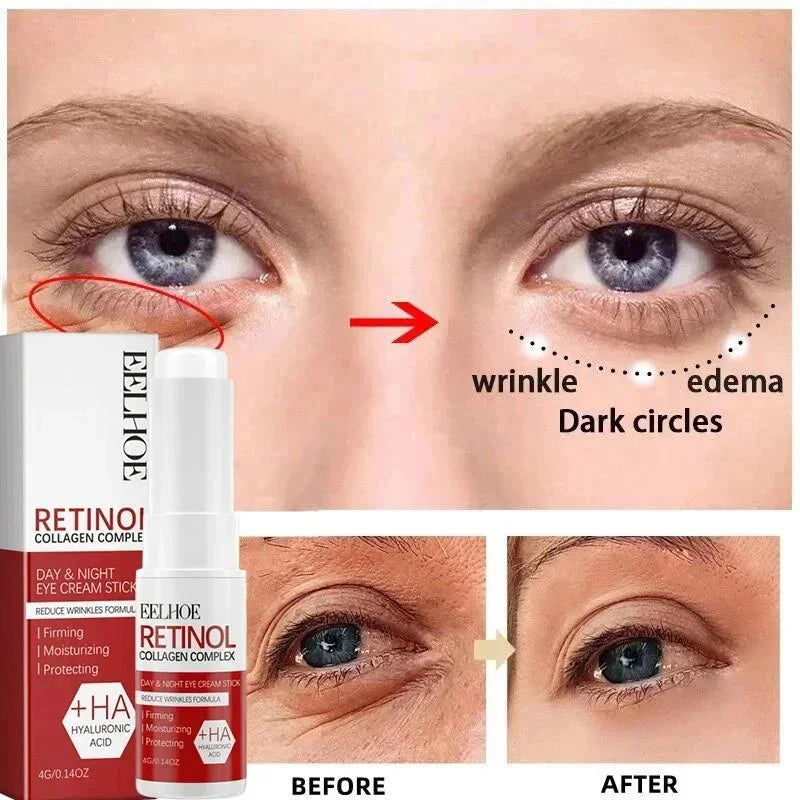 RevitLift™ Retinol Pro - Enrichment Kit | Advanced Firming & Fine Line Recovery - GiftWave.co